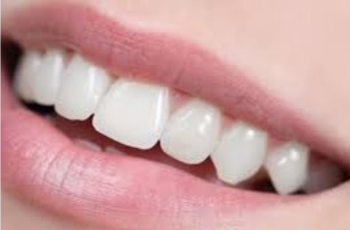 Dentifrice Mousse - Smile éclat V34